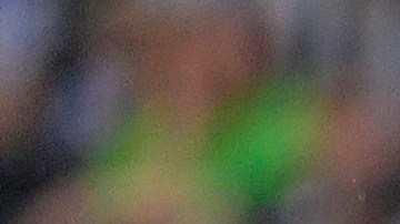 El jugador podría estar al menos ocho semanas de recuperación en caso de no ser operado.