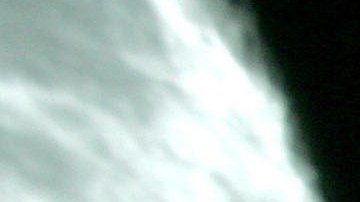 Esta IA tiene la capacidad para identificar a los no fumadores con mayor riesgo de desarrollar cáncer de pulmón.