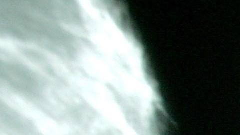 Esta IA tiene la capacidad para identificar a los no fumadores con mayor riesgo de desarrollar cáncer de pulmón.