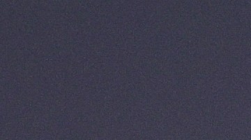 El jugador español sufrió una fuerte lesión que lo envió directo al hospital.