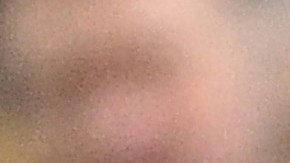 Konstantinos Tsimikas sufrió fracturó la clavícula tras chocar con Klopp