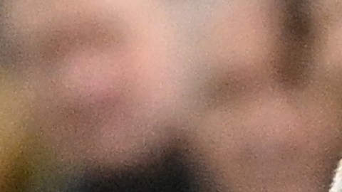 Konstantinos Tsimikas sufrió fracturó la clavícula tras chocar con Klopp