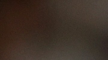 Luis Severino, lanzador dominicano.