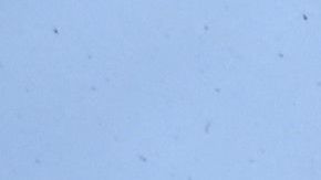 El Coronel ruso murió al "pisar una mina".