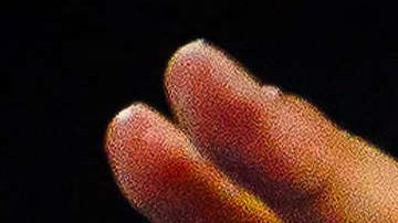 Rafa Nadal anuncia que no estará en el Abierto de Australia tras sufrir una nueva lesión