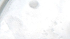 Los insectos como fuente imporante de alimentación.