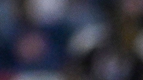 El guardameta afirmó que casi piierde la mano debido a una infección tras operarse de una lesión.