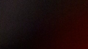 70% de fanáticos que asistieron al partido de playoffs entre Chiefs y Dolphins necesitan amputaciones