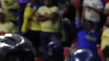 Israel Reyes operado con éxito: El defensor salió lesionado de la rodilla del Clásico ante Chivas