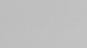 Middle,Aged,Bikini,Model