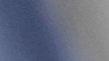 Atlanta Braves pierden al curazoleño Ozzie Albies por fractura en dedo gordo del pie derecho