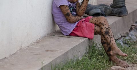 Los organismos de Colombia y Estados Unidos le están ofreciendo toda la atención a las menores abusadas.