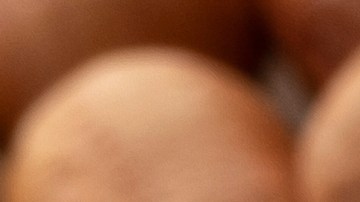 Carter, según la demanda, advirtió que era alérgico al maní y les mostró su EpiPen que siempre lleva consigo en caso de que tenga una reacción.