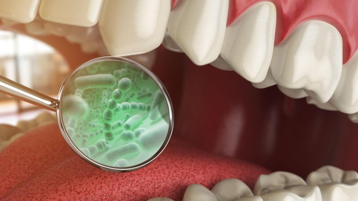 Los peligros de las bacterias bucales: 4 enfermedades que debes conocer