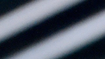 Céline Dion fue diagnosticada con el síndrome de la persona rígida.