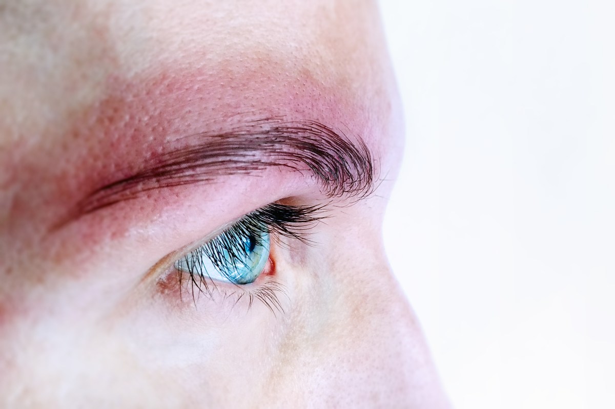 Pensó que era alérgica al maquillaje y descubre que tiene cáncer