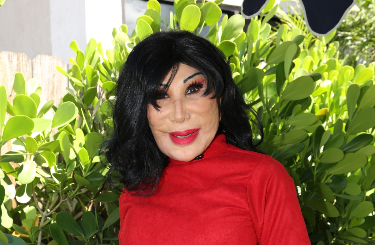 Lyn May habló de sus procedimientos estéticos y la vez que le inyectaron aceite en el rostro