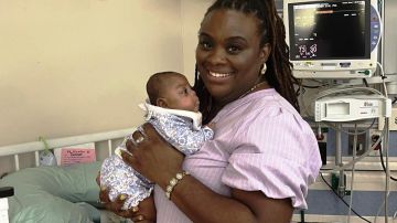 Shyne Graham sobrevivió tras nacer prematura con 1 libra 11 onzas de peso en NY en enero 2024.