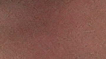 Novak Djokovic sufrió este miércoles una lesión en su rodilla derecha.