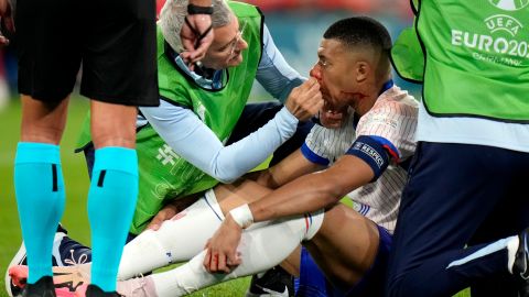 Kylian Mbappé es atendido por el cuerpo médico de Francia.