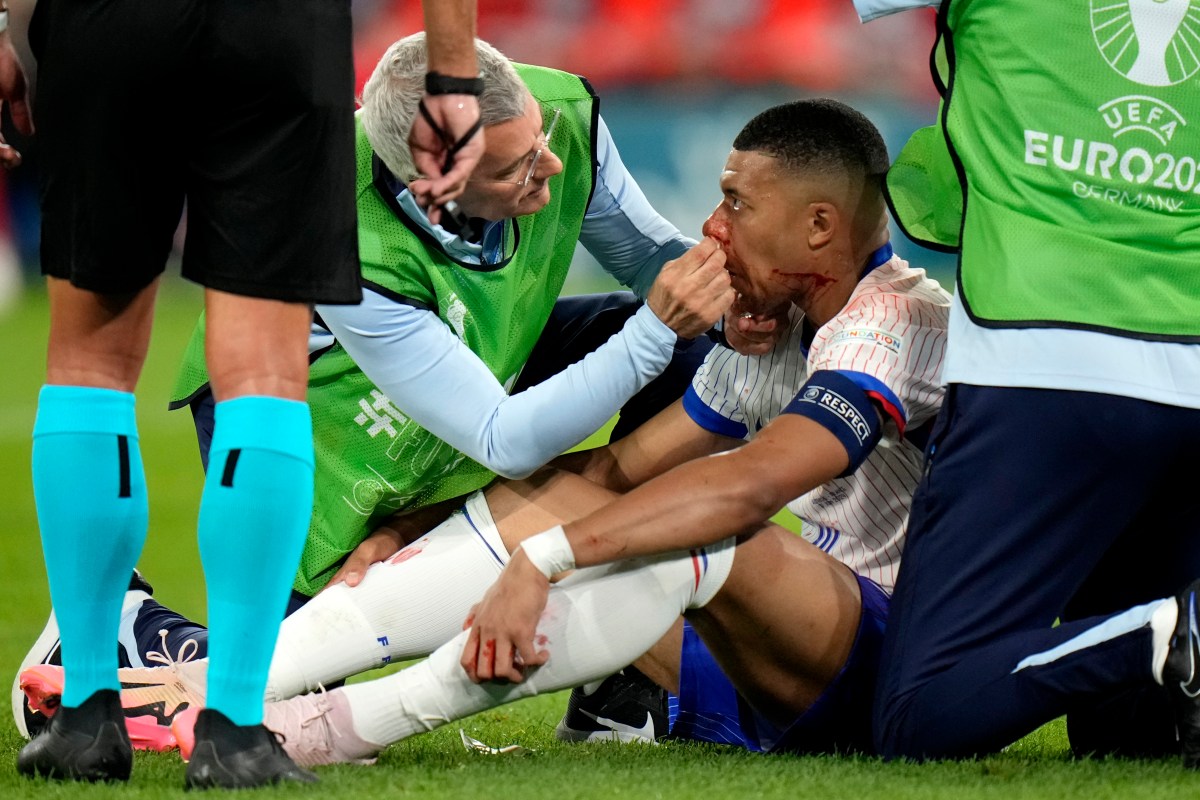 Celebra Francia: Kylian Mbappé no sería operado de su nariz y estaría listo para duelo ante Países Bajos