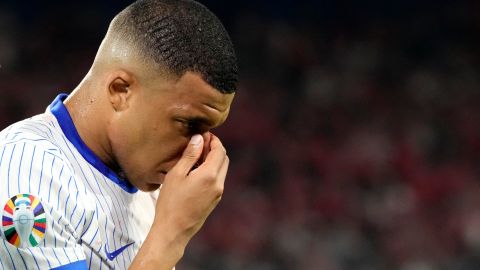 Kylian Mbappé sufrió en fractura de nariz en el debut de la Eurocopa.