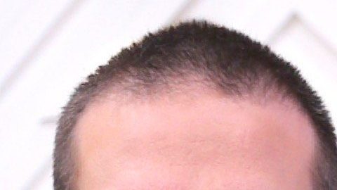 Clovis defiende su amor y su relación con Aleska Génesis ante todos.