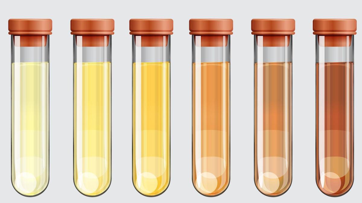 Descubriendo el significado detrás del color de tu orina