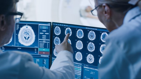 Cáncer cerebral