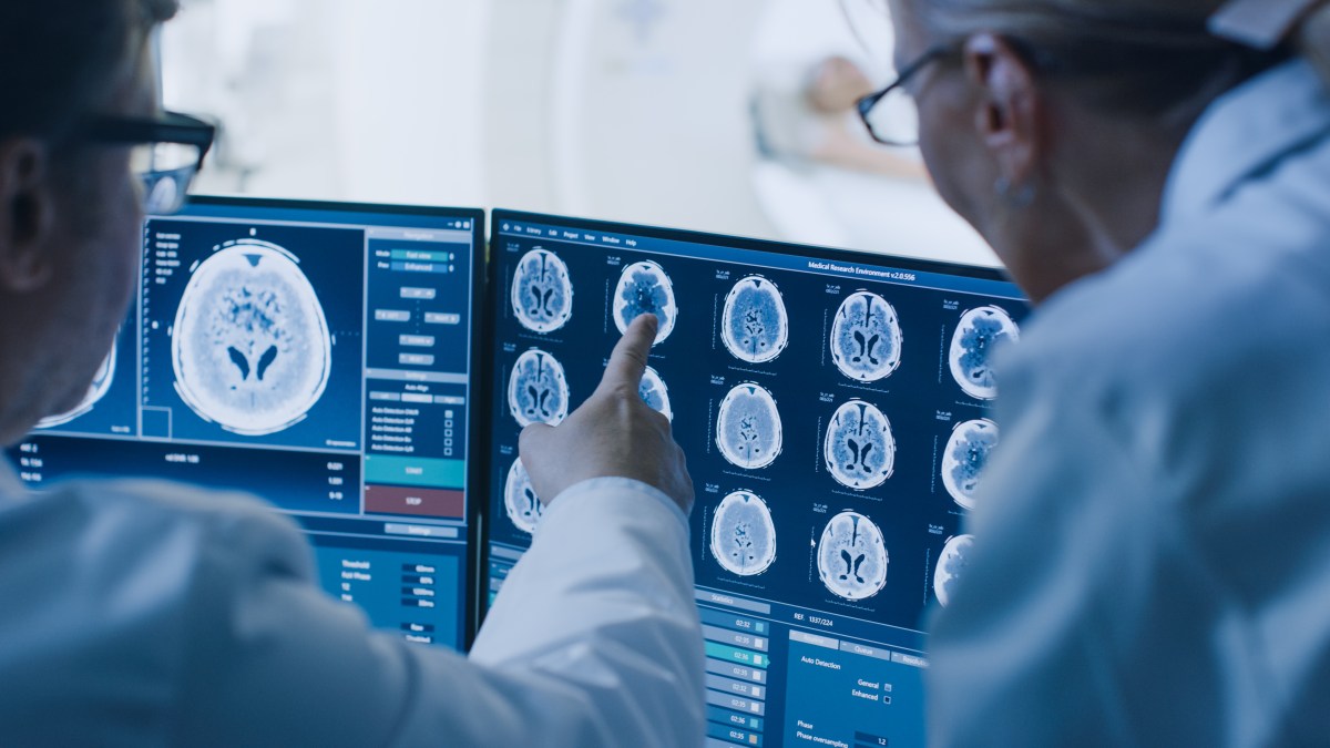 Le descubren extraño cáncer cerebral tras sufrir repentinos dolores de cabeza