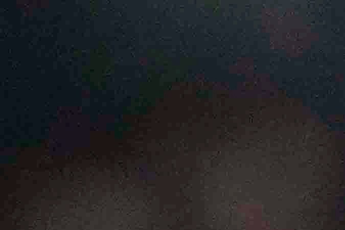 Bendaje en rodilla de Natalia Escalera. Foto:/Martin Mejia/AP.