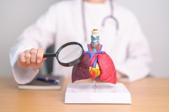 Síntomas del cáncer de pulmón Médico revisando los pulmones, imagen ilustrativa