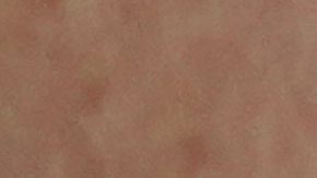 Ciclista Alice Toniolli permanece en cuidados intensivos tras grave caída