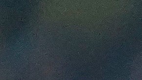 El jugador del Club América salió exitoso de la operación en la rodilla derecha.