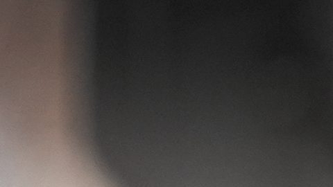 New York Yankees en problemas: Anthony Rizzo sufre fractura en dos dedos