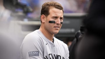 New York Yankees en problemas: Anthony Rizzo sufre fractura en dos dedos