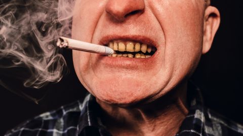 Dientes fumar