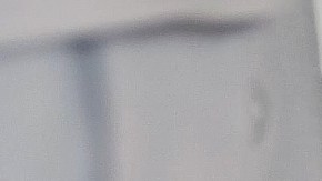 La listeria es una bacteria que causa infecciones graves con síntomas como que van desde la fiebre, dolores musculares, dolor de cabeza, rigidez en el cuello, entre otros.