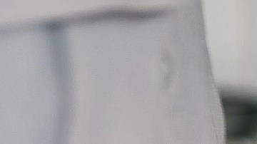 La listeria es una bacteria que causa infecciones graves con síntomas como que van desde la fiebre, dolores musculares, dolor de cabeza, rigidez en el cuello, entre otros.