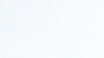 De acuerdo con Britney Spears, el dolor que experimentó era insoportable.