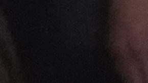 Amanda Serrano sufrió una fuerte herida en plena pelea.