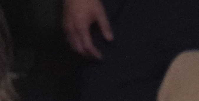 Amanda Serrano sufrió una fuerte herida en plena pelea.