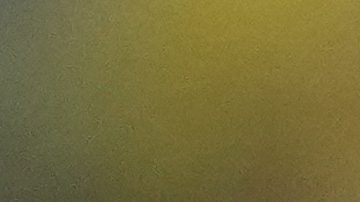 Emiliano 'Dibu' Martínez.