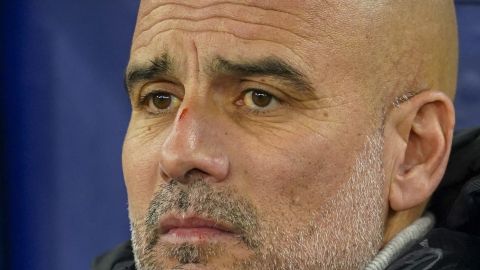 Pep Guardiola con heridas.