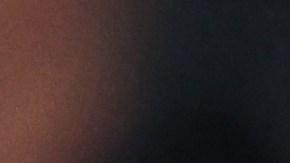 Pep Guardiola ya mostraba el corte de su nariz durante el juego.