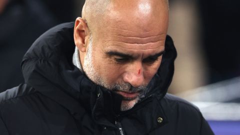 Pep Guardiola ya mostraba el corte de su nariz durante el juego.