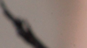 El joven se sometió a una operación para tratar de reparar su retina luego del hecho que ocurrió en mayo de 2022, pero su condición sigue deteriorándose.