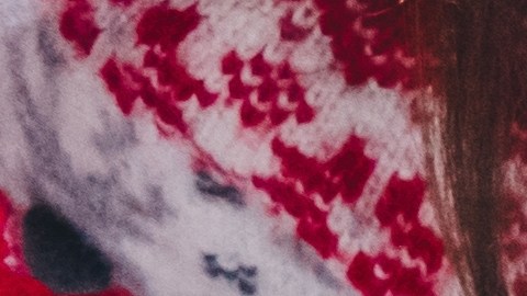 Evite consumir alimentos ácidos, grasosos, el alcohol o picantes, ya que irritan el estómago.