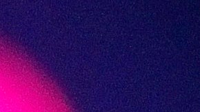 Raphael fue ingresado de emergencia al hospital en Madrid.