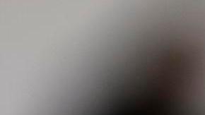 Gianluigi Donnarumma luego de recibir el golpe al rostro.